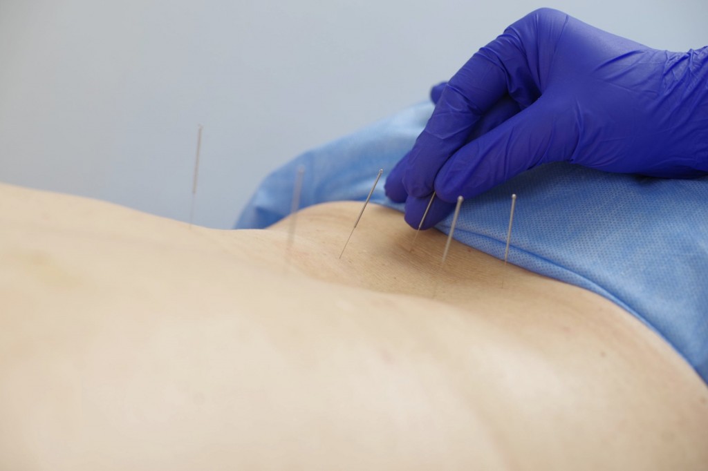 sanatoriul constructorul acupunctura