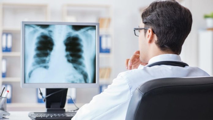screening-pulmonar screening pulmonar